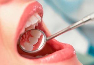 Implantes Dentales - Especialista en periodoncia - Especialidades - Odontologia